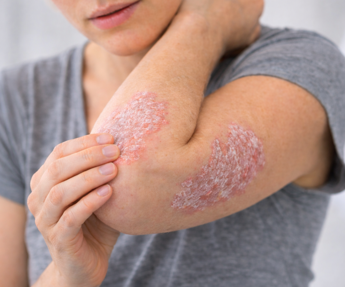 Inflammatory Skin Problems Inflammatory Skin Conditions – Dr Tom King